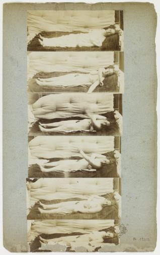 Albert Londe  [1858-1917] Phases successives  d’une attaque hystérique Tirages albuminés  collés sur carton Vers 1885 Collection Beaux-Arts de Paris