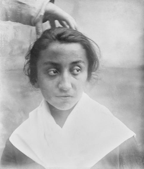 Charles-Émile  François-Franck  [1849-1921] Leçons des émotions Diapositive sur verre Entre 1899 et 1902 Collection Collège de France