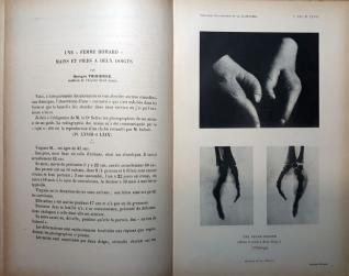 Paul Richer, Henry Meige, Nouvelle iconographie de la Salpêtrière : iconographie médicale et artistique 21ème année, n°6, Masson et Cie, novembre-décembre 1908